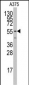 PTRF Antibody (C-term)